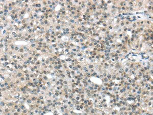 Anti-Human/Mouse TRIP6 Antibody