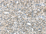 Anti-Human/Mouse TRIP6 Antibody - ABMIUM