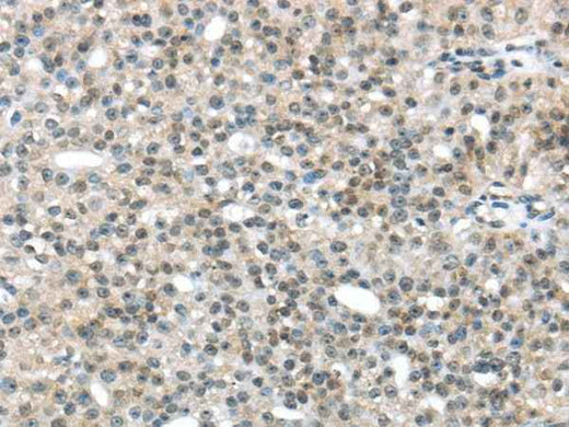 Anti-Human/Mouse TRIP6 Antibody