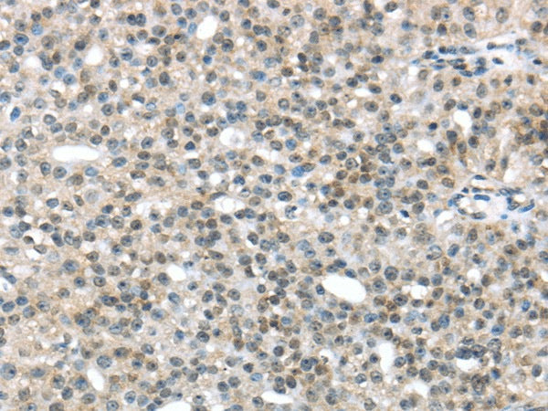 Anti-Human/Mouse TRIP6 Antibody - ABMIUM
