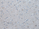 Immunohistochemistry of paraffin-embedded Human brain tissue using UBR4 Polyclonal Antibody at dilution of 1:65(×200)