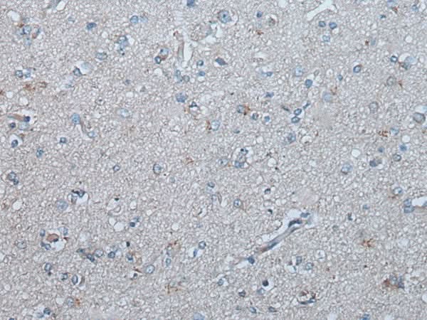 Immunohistochemistry of paraffin-embedded Human brain tissue using UBR4 Polyclonal Antibody at dilution of 1:65(×200)