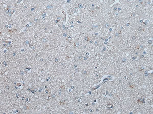 Immunohistochemistry of paraffin-embedded Human brain tissue using UBR4 Polyclonal Antibody at dilution of 1:65(×200)