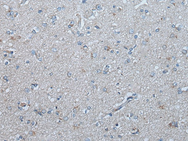 Immunohistochemistry of paraffin-embedded Human brain tissue using UBR4 Polyclonal Antibody at dilution of 1:65(×200)