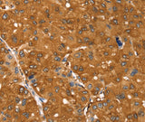 Anti-Human SSTR3 Antibody - ABMIUM