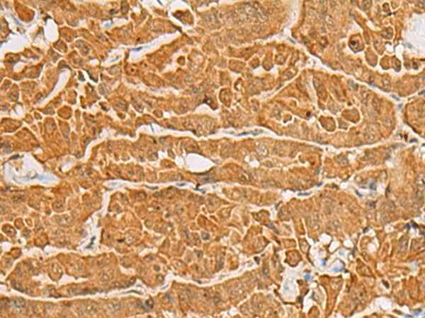 Anti-Human/Mouse/Rat MAPK14 Antibody
