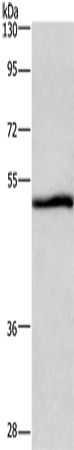 Anti-Human NRG1 Antibody - ABMIUM