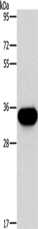 Anti-Human/Mouse HOXB13 Antibody - ABMIUM