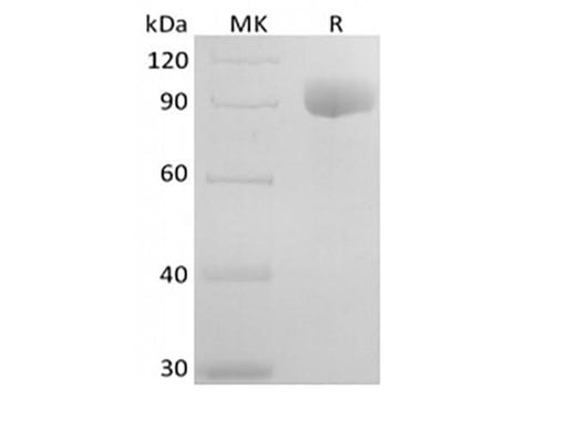 Recombinant Human IL-6RA (C-Fc) - ABMIUM