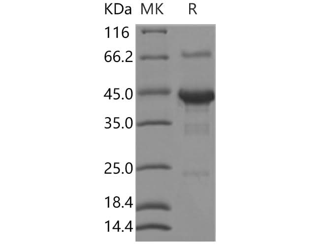 Recombinant Human SHISA3 Protein (Fc Tag) - ABMIUM