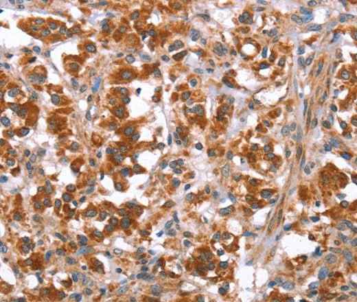 Anti-Human GLMN Antibody