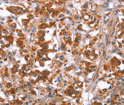 Anti-Human GLMN Antibody - ABMIUM