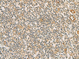 Immunohistochemistry of paraffin-embedded Human tonsil tissue using RAB13 Polyclonal Antibody at dilution of 1:50(×200)