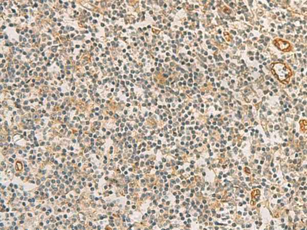 Anti-Human/Mouse/Rat RAB13 Antibody