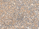 Immunohistochemistry of paraffin-embedded Human tonsil tissue using ABCB4 Polyclonal Antibody at dilution of 1:40(×200)