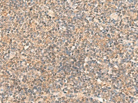 Immunohistochemistry of paraffin-embedded Human tonsil tissue using ABCB4 Polyclonal Antibody at dilution of 1:40(×200)
