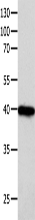 Anti-Human FOXL1 Antibody - ABMIUM