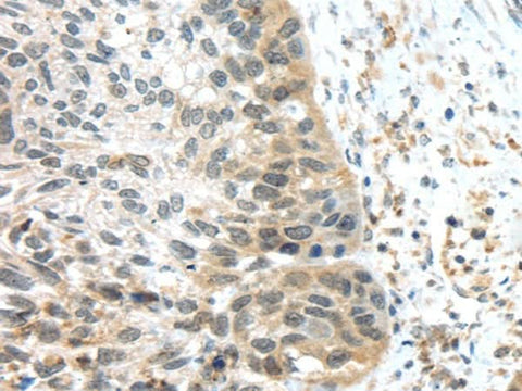 Anti-Human TSPY1/3 Antibody - ABMIUM