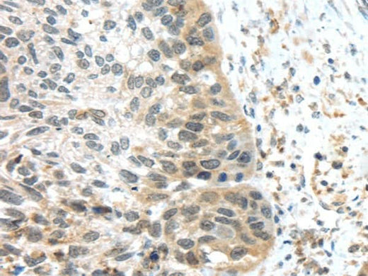 Anti-Human TSPY1/3 Antibody - ABMIUM