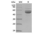 Recombinant Human CD3 epsilon/CD3E (C-Fc-Avi) Biotinylated - ABMIUM