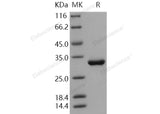 Recombinant Human HAGH/GLO2/Glyoxalase II Protein (His Tag) - ABMIUM