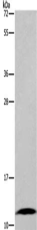 Anti-Human/Mouse FABP6 Antibody - ABMIUM