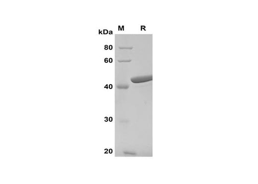 SDS-PAGE analysis of Mouse Serpin E1/PAI-1 proteins, 2 μg/lane of Recombinant Mouse Serpin E1/PAI-1 proteins was resolved with SDS-PAGE under reducing conditions, showing bands at 42 kDa.