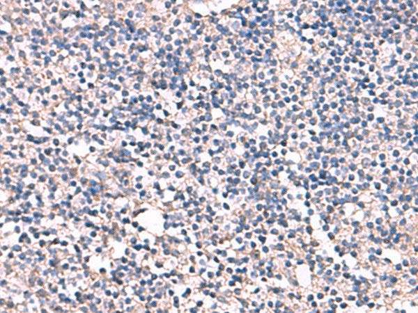 Immunohistochemistry of paraffin-embedded Human tonsil tissue using ESM1 Polyclonal Antibody at dilution of 1:55(×200)
