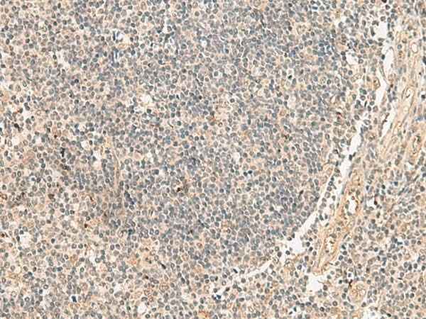 Anti-Human/Mouse/Rat PAF1 Antibody