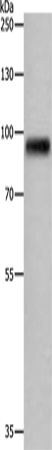 Anti-Human/Mouse APLP1 Antibody - ABMIUM