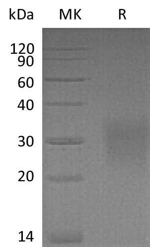 Recombinant Mouse CD83/HB15 Protein (aa 22-134, His Tag) - ABMIUM