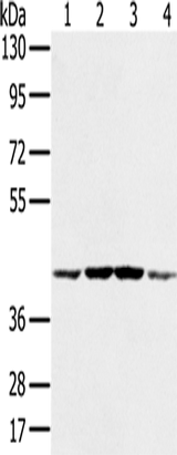 Anti-Human/Mouse/Rat PAICS Antibody - ABMIUM