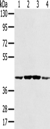 Anti-Human/Mouse/Rat PAICS Antibody - ABMIUM