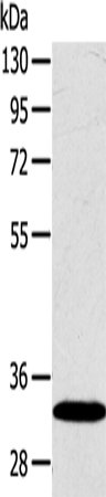 Anti-Human SULT2A1 Antibody - ABMIUM