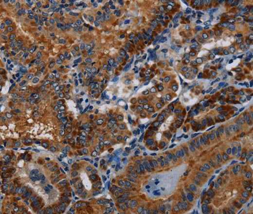 Anti-Human PIDD1 Antibody