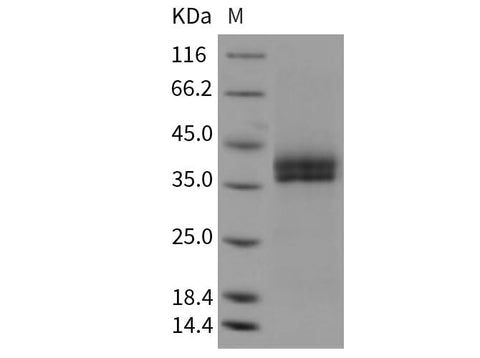Recombinant Mouse Kallikrein 11/KLK11 Protein (His Tag) - ABMIUM