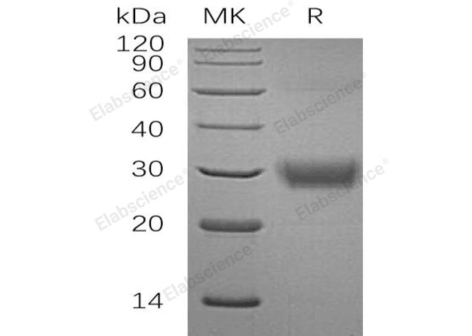 Recombinant Human CD32a/FCGR2A Protein (His Tag) - ABMIUM