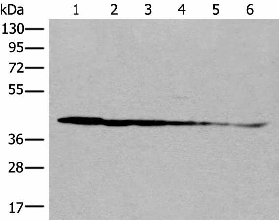 Western blot analysis of Rat brain tissue Human cerebrum tissue Human fetal brain tissue Hela cell Human breast cancer tissue Jurkat cell lysates using PITPNB Polyclonal Antibody at dilution of 1:500