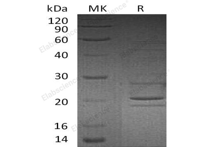 Recombinant Human Syntaxin-8/STX8 Protein - ABMIUM