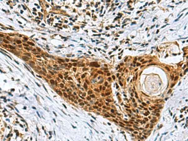 Anti-Human/Mouse/Rat NABP1 Antibody
