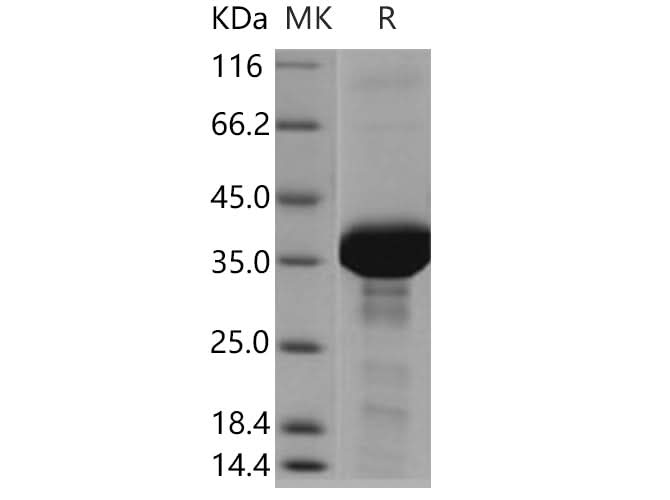 > 85 % as determined by reducing SDS-PAGE.