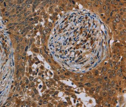 Anti-Human OSM Antibody