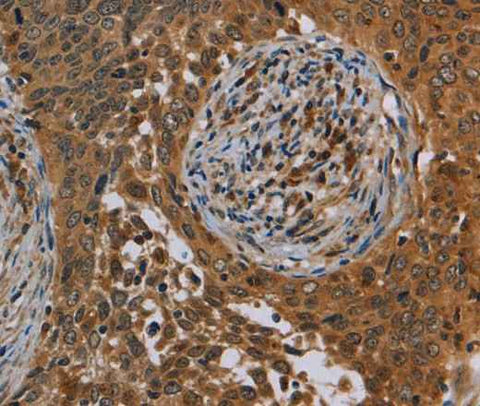 Anti-Human OSM Antibody