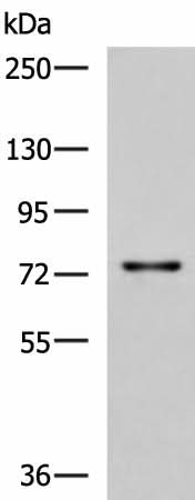Western blot analysis of Rat liver tissue lysate using TGFBI Polyclonal Antibody at dilution of 1:850