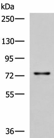 Western blot analysis of Rat liver tissue lysate using TGFBI Polyclonal Antibody at dilution of 1:850