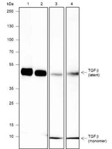 Anti-Human/Rat/Mouse TGF beta 1 Antibody [A618]