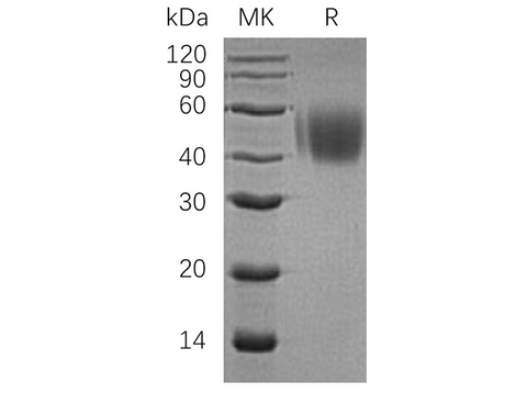 Recombinant Human CD150/SLAMF1 Protein (His Tag) - ABMIUM