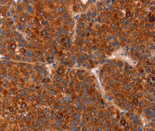 Anti-Human GC Antibody