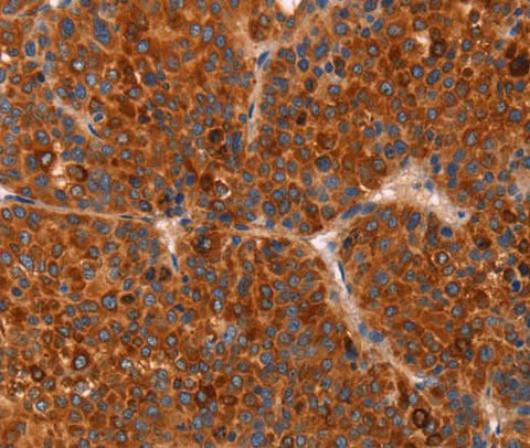 Anti-Human GC Antibody - ABMIUM