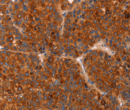 Anti-Human GC Antibody - ABMIUM